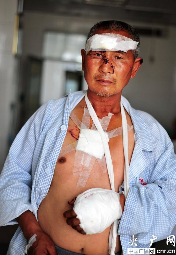 新疆发生狼群袭人事件 6人受伤1人耳朵被咬掉【2】
