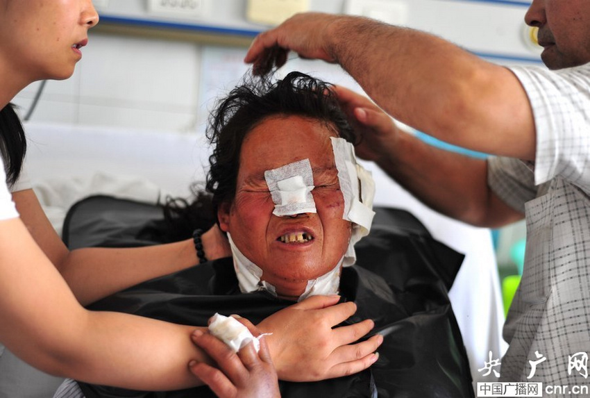 新疆发生狼群袭人事件 6人受伤1人耳朵被咬掉【5】