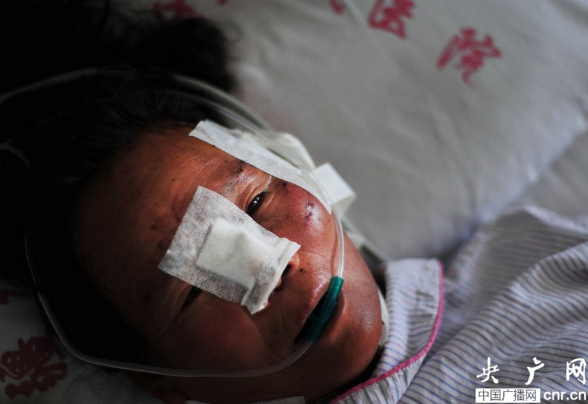 新疆发生狼群袭人事件 6人受伤1人耳朵被咬掉【7】