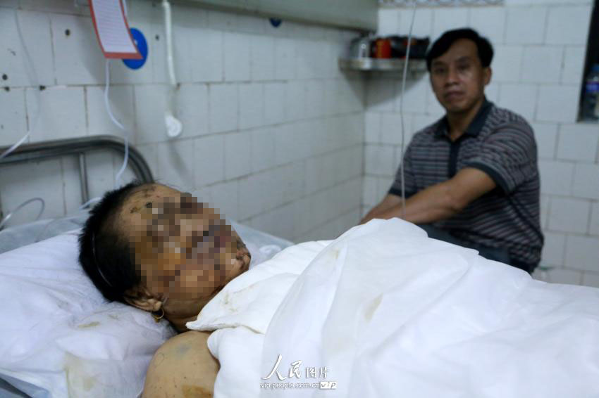 9月22日晚，湖南省醴陵市浦口镇保丰村南阳出口花炮厂发生爆炸事故中的伤者在醴陵中医院抢救治疗。