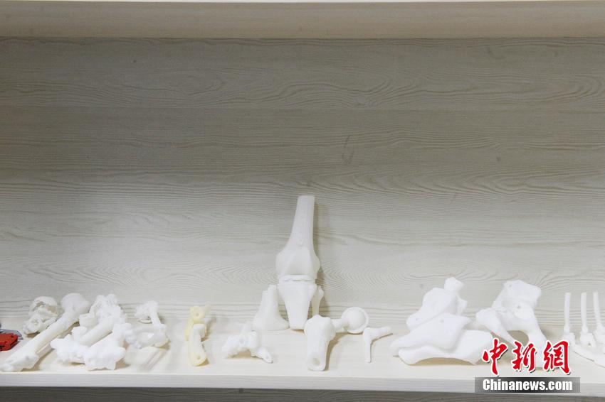 ͼΪ3D��ӡ������ҽѧ�е�Ӧ�ò�ֹ�ڴ�ӡ�����岿�������ǰ�������Ƽ��塢ģ�ⰲװ��һϵ�и��������������������˸��లȫ�ԡ�