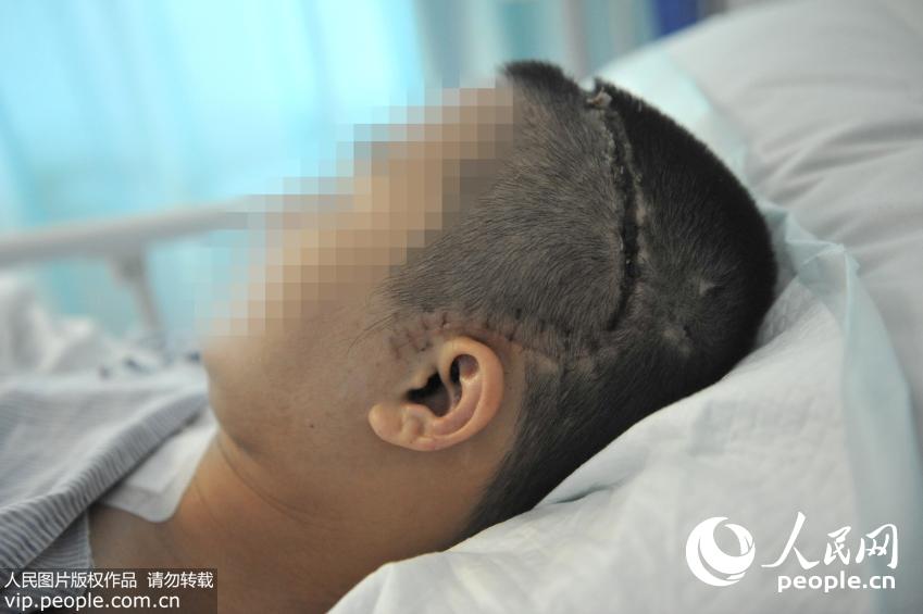 ���Ѻ����ĳͷ����Ȼ����������˿ڷ�Ϻۼ���