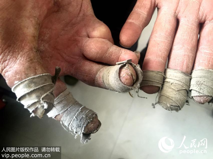 10��12�գ�ʰ������˫�֣������ָճ�Ͻ�����